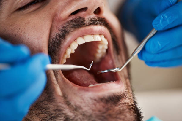 Best Emergency Cosmetic Dentistry (e.g., broken veneers) in Stonecrest, GA